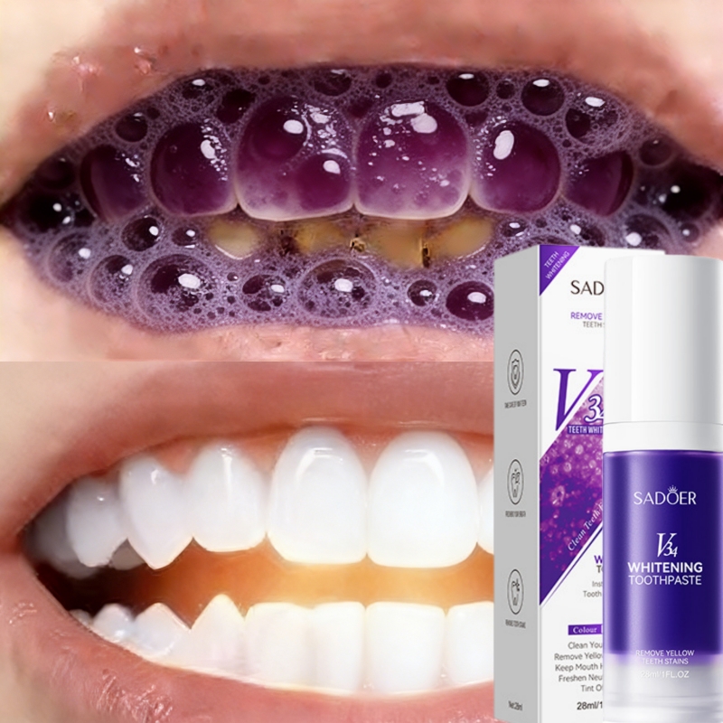 Teeth Whitening Effective - 2026'nın En Çok Satan Beyazlatıcı Diş