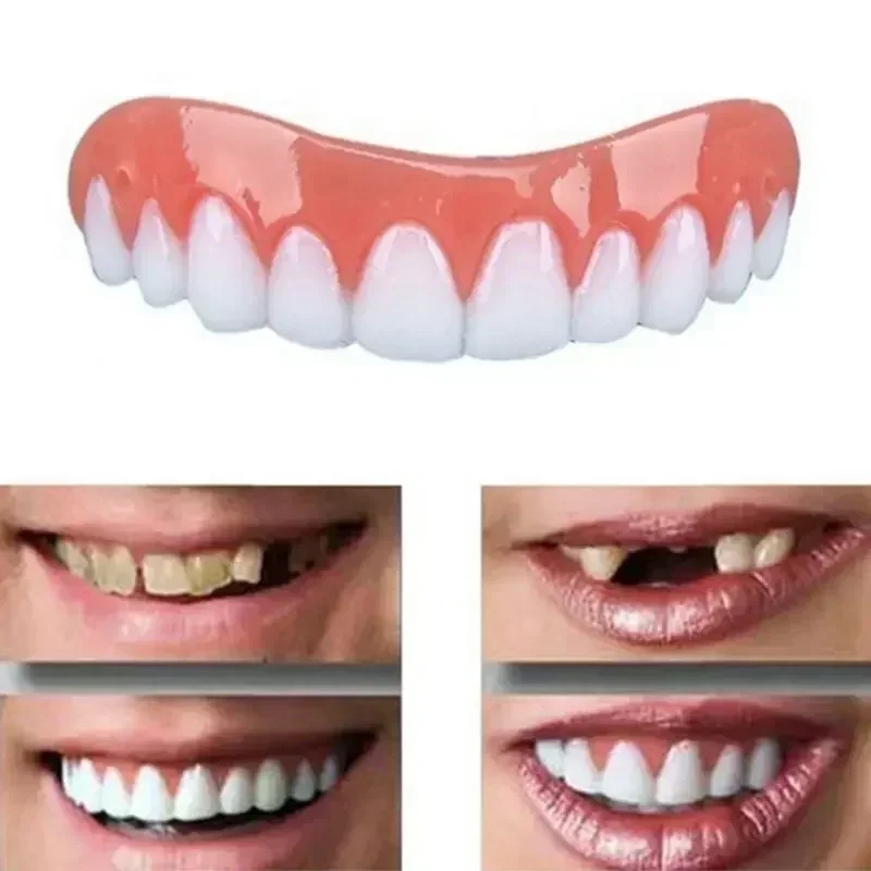 Teeth Whitening With Braces - Yeni Takma Dişler Silikon Üst ve