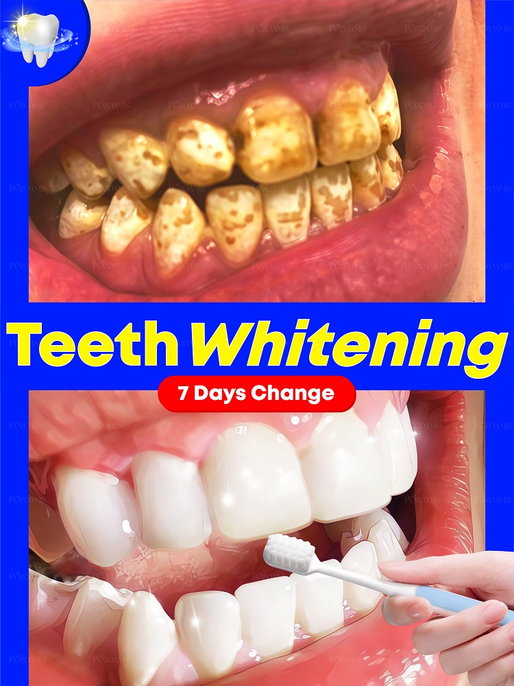 Teeth Whitening Effective - Diş beyazlatmak için 2025'in yeni siyah