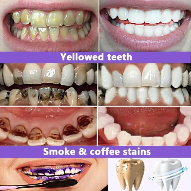 2026'nın En Çok Satan Beyazlat - Teeth Whitening Effective incelemesi ve fiyatı