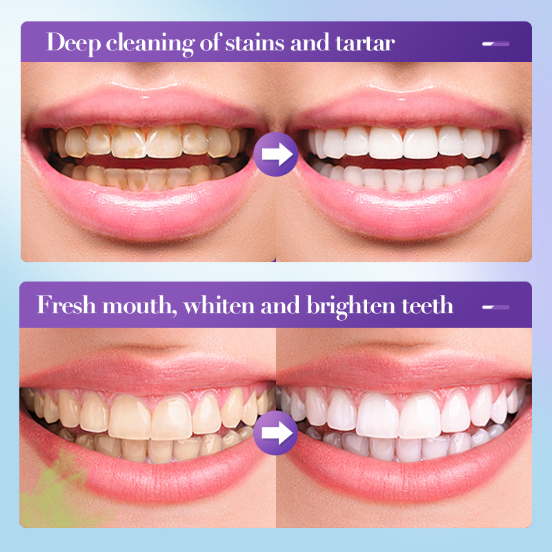 2026'nın En Çok Satan Beyazlat - Teeth Whitening Effective incelemesi ve fiyatı