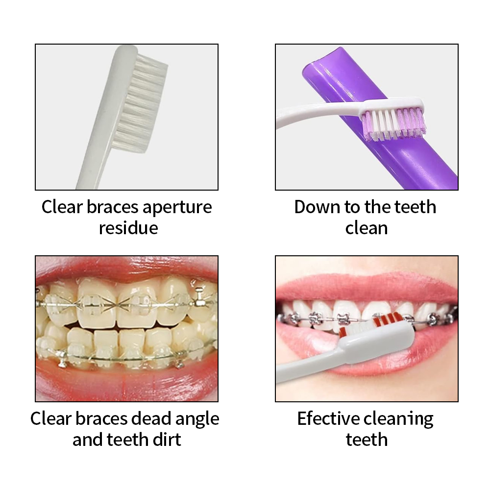8 adet/takım ortodonti diş bak - Teeth Whitening With Braces incelemesi ve fiyatı