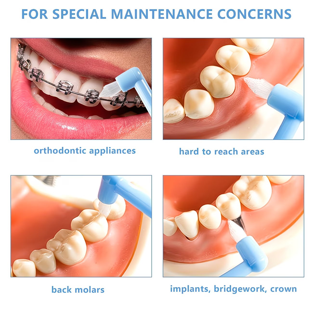 1/3 adet ortodontik diş teli f - Teeth Whitening With Braces incelemesi ve fiyatı