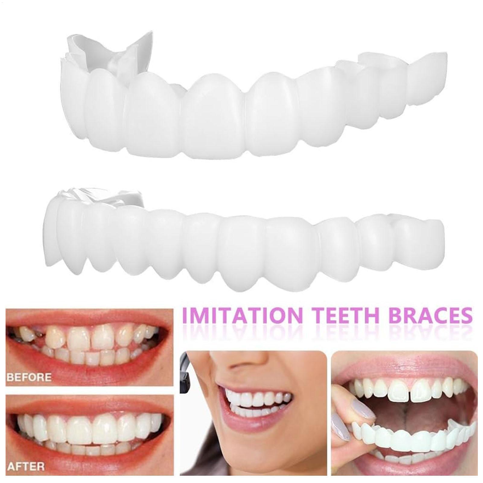 Diş Üst Alt Takma Diş Kaplamas - Teeth Whitening With Braces incelemesi ve fiyatı