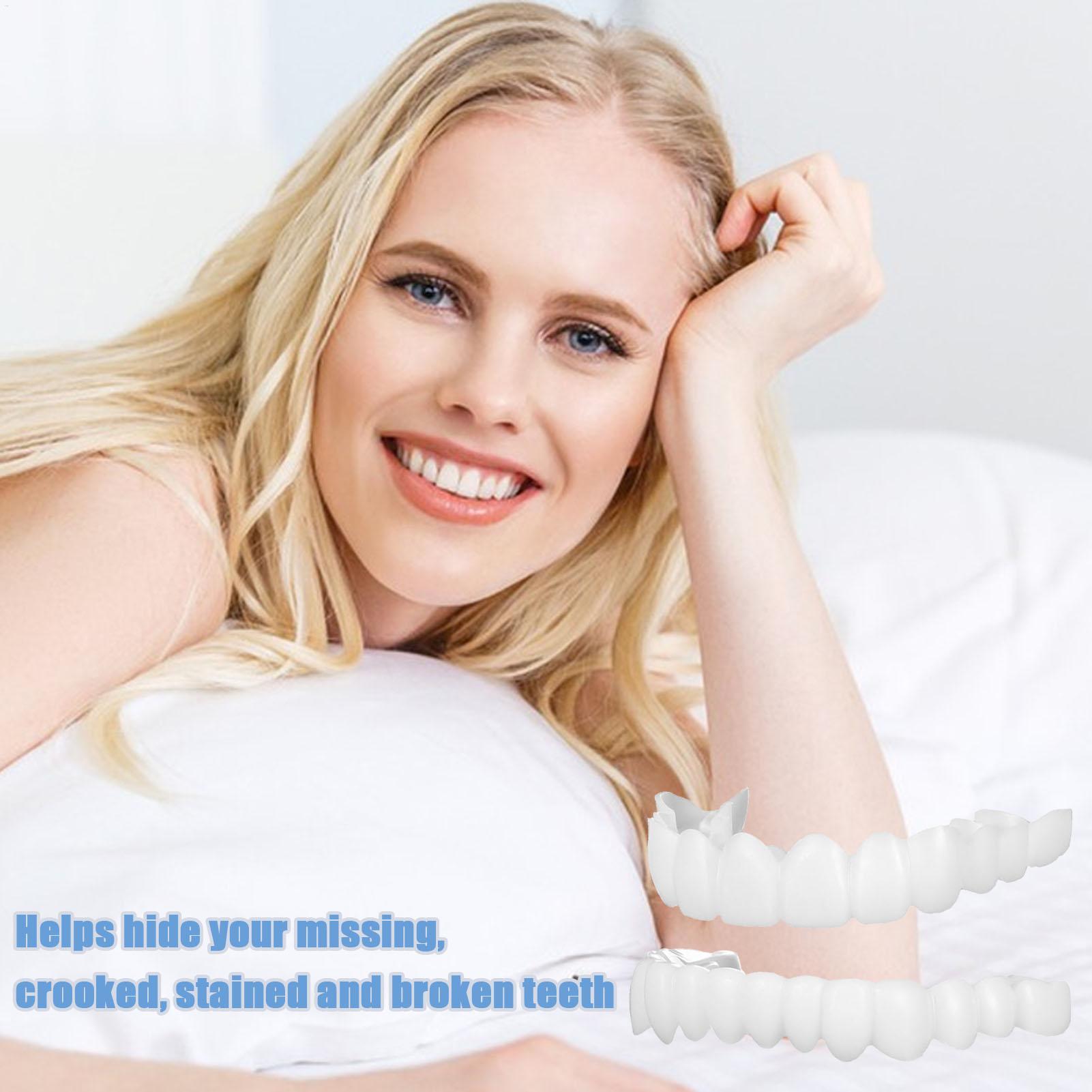 Diş Üst Alt Takma Diş Kaplamas - Teeth Whitening With Braces incelemesi ve fiyatı