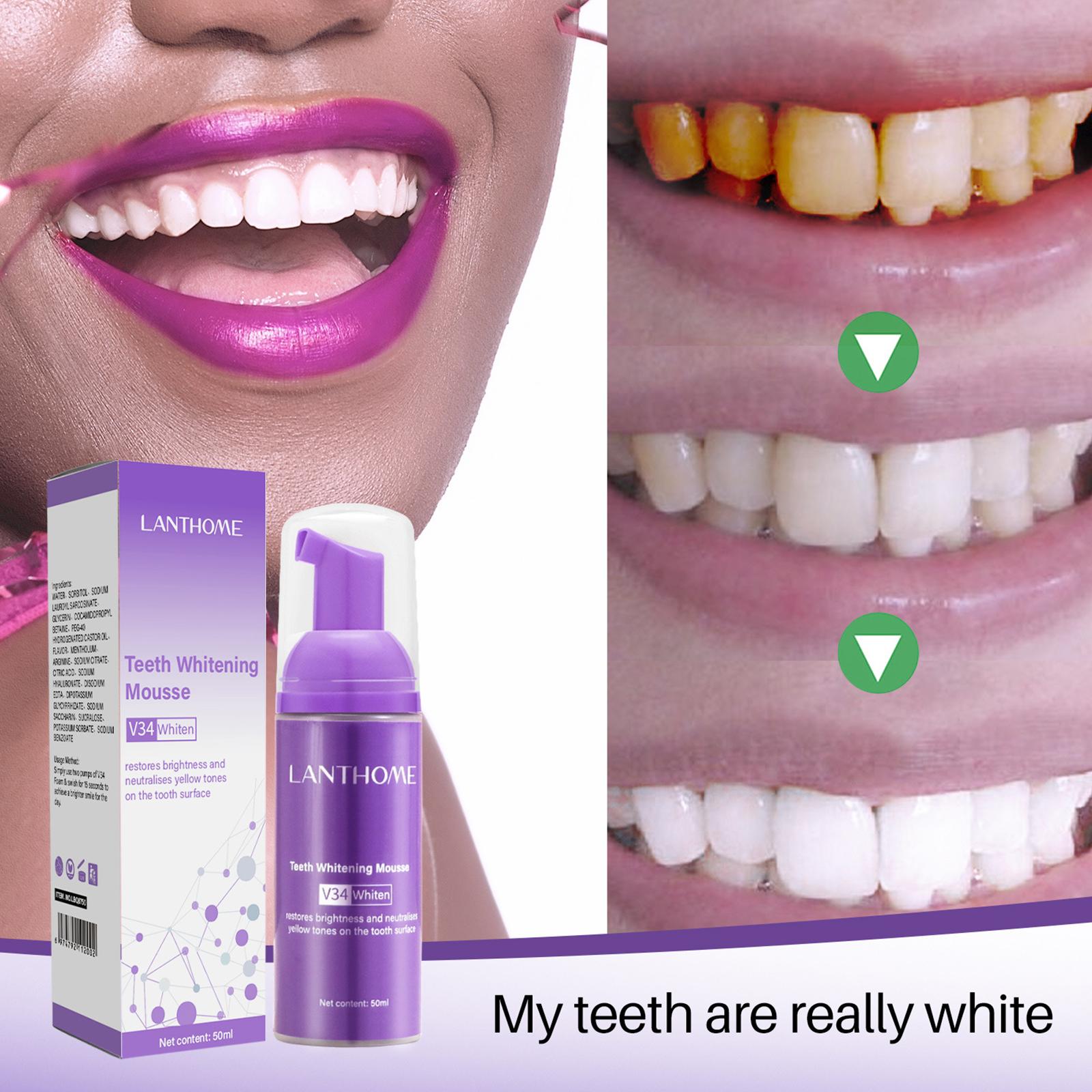 V34 Köpük Diş Temizleme Diş Ma - Teeth Whitening Effective incelemesi ve fiyatı