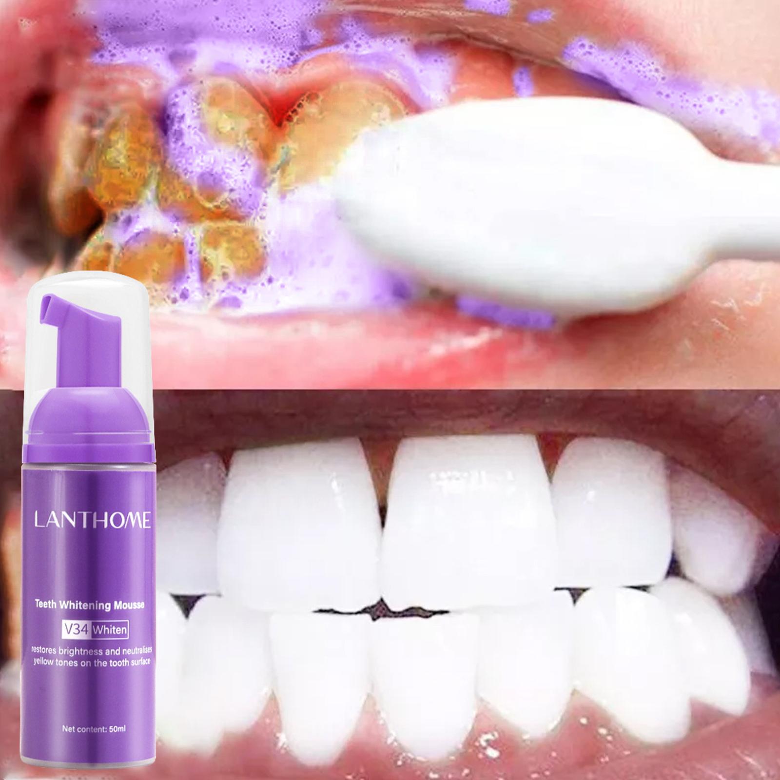 V34 Köpük Diş Temizleme Diş Ma - Teeth Whitening Effective incelemesi ve fiyatı