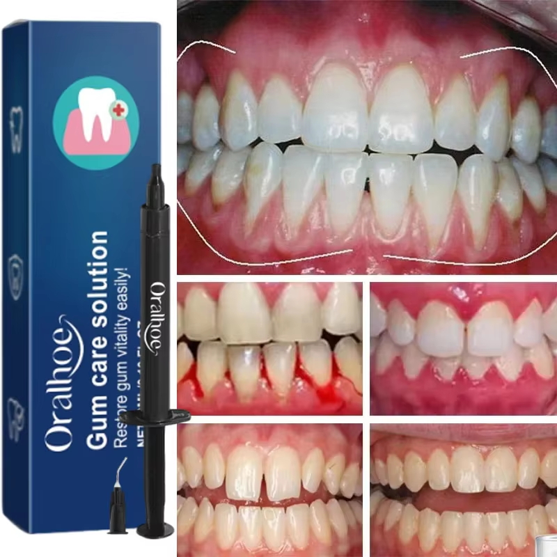 Diğer adımlar: Diş Beyazlatma  - Teeth Whitening Gels incelemesi ve fiyatı