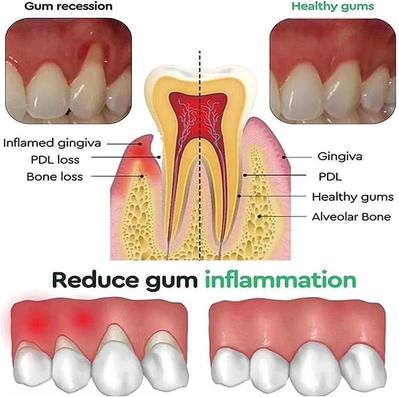 Diğer adımlar: Diş Beyazlatma  - Teeth Whitening Gels incelemesi ve fiyatı