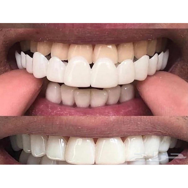Yumuşak silikon jel diş ağız ü - Teeth Whitening Moulds incelemesi ve fiyatı