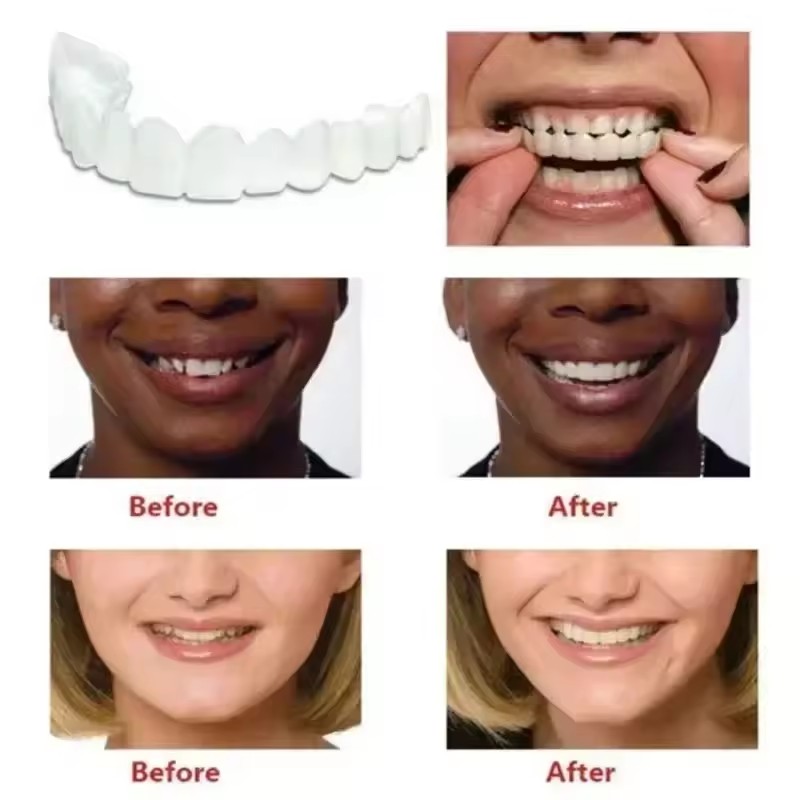 Diş Kaplamaları Beyazlatma Pro - Teeth Whitening With Braces incelemesi ve fiyatı