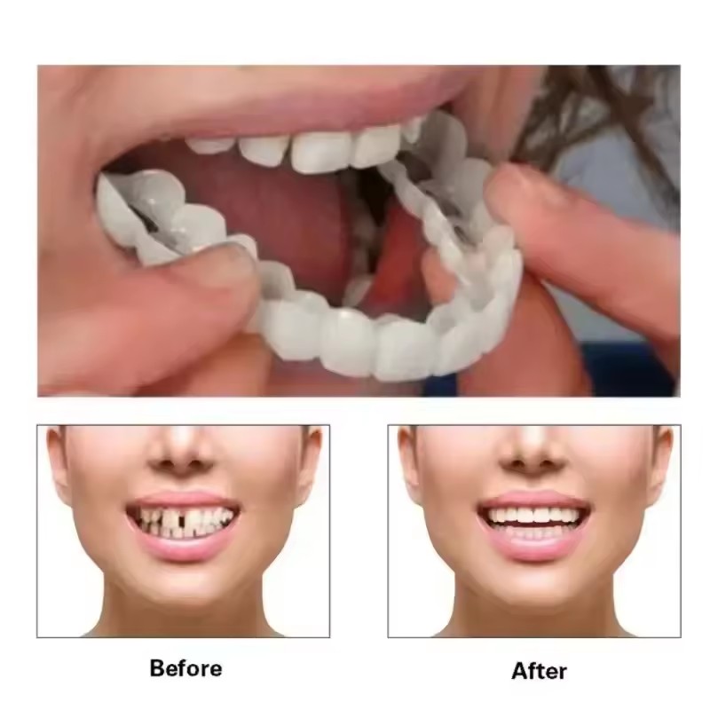 Diş Kaplamaları Beyazlatma Pro - Teeth Whitening With Braces incelemesi ve fiyatı