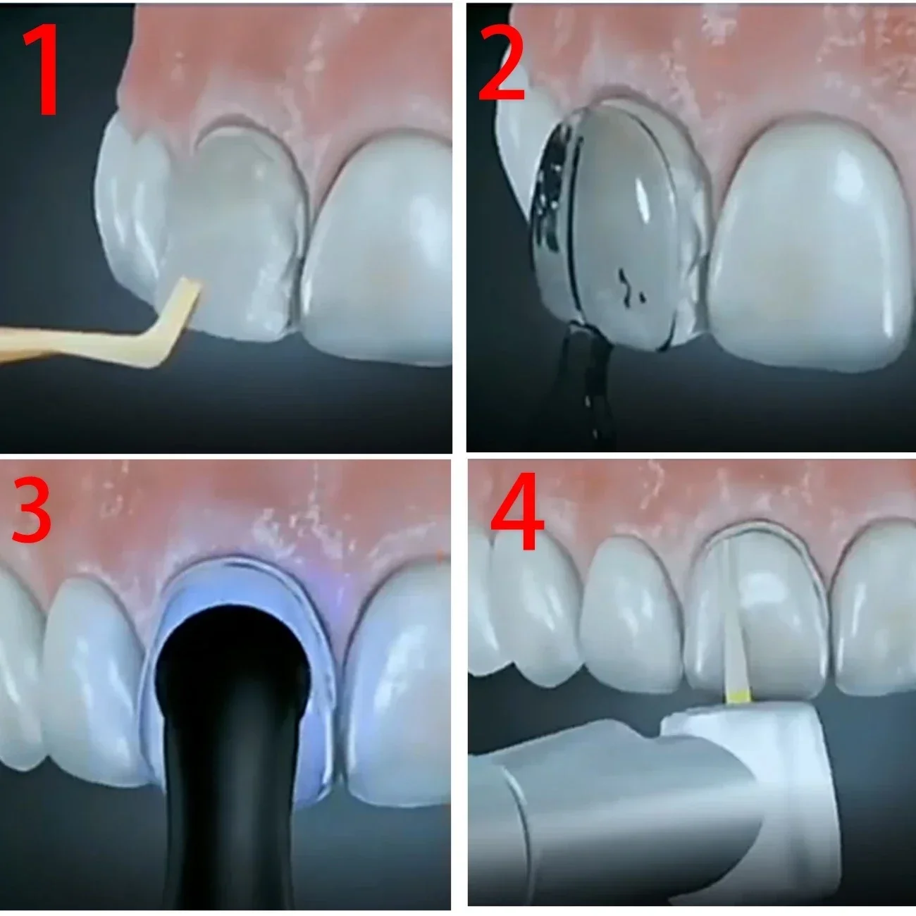 2 takım diş laboratuvarı kalıp - Teeth Whitening Moulds incelemesi ve fiyatı