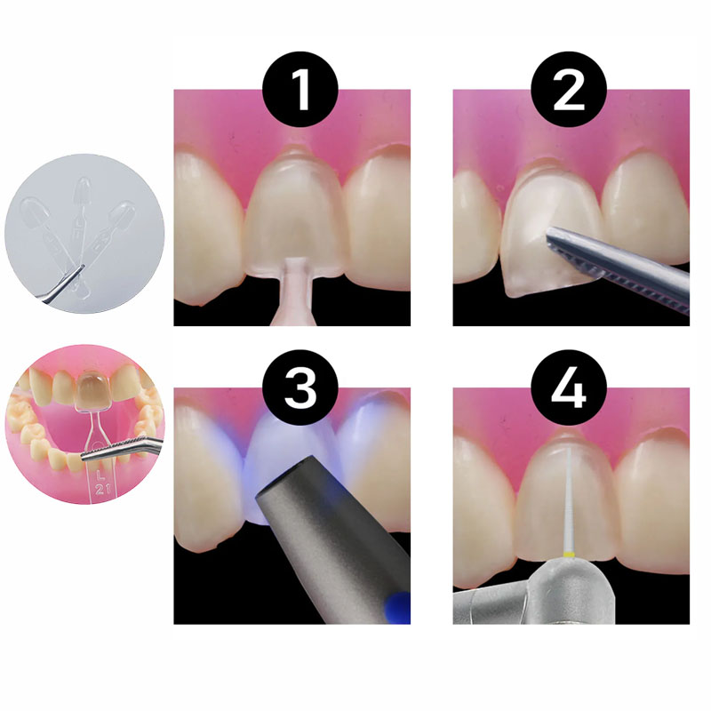 32 adet/takım Kompozit Reçine  - Teeth Whitening Moulds incelemesi ve fiyatı