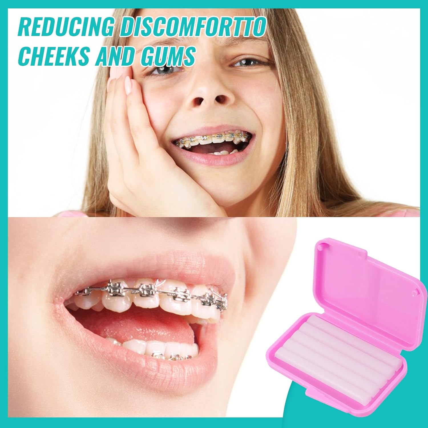 10 kutu diş ortodonti rahatlat - Teeth Whitening With Braces incelemesi ve fiyatı