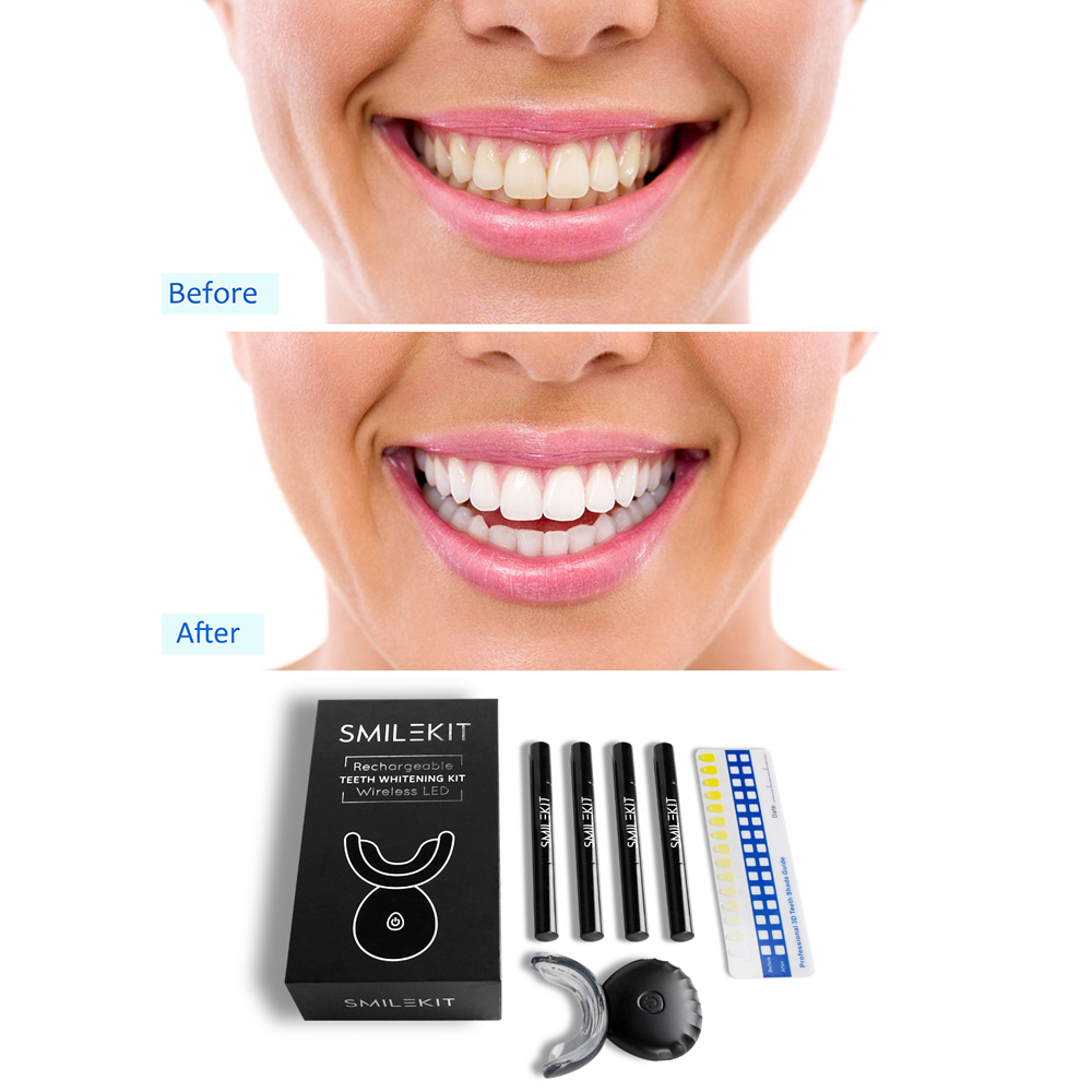 Yeni elektrikli diş beyazlatma - Teeth Whitening Led Kit incelemesi ve fiyatı