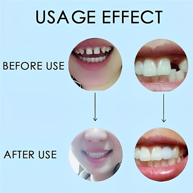 [YENİ!ABMK】 2 Çift, Güzel Gülü - Teeth Whitening With Braces incelemesi ve fiyatı