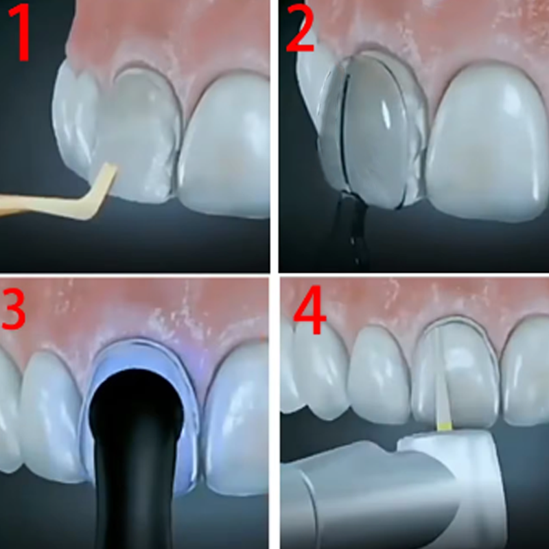 32 adet/kutu diş kaplama kalıp - Teeth Whitening Moulds incelemesi ve fiyatı